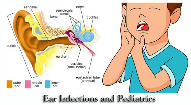 Ear Infections and Pediatrics